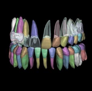 Natural anatomy teeth with root canal in 2 pieces
