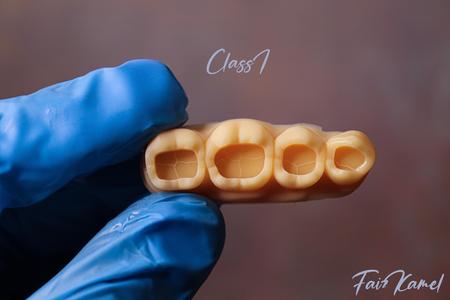 Dental Upper and Lower Arch Class 1 Models