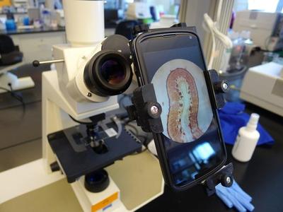 Universal Camera Phone/Microscope Adapter