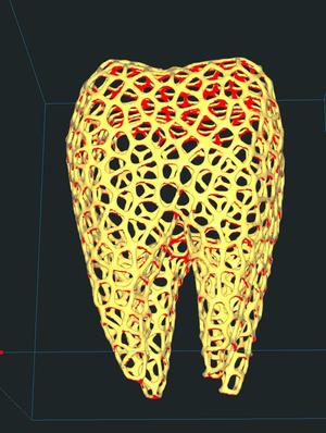 Voronoi tooth