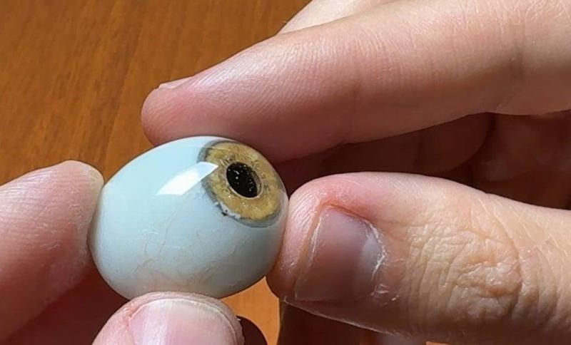 Ophthalmic prosthesis (artificial eye), enucleation