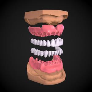 Dental Anatomy Mouth Model Real Scanned Medical Case