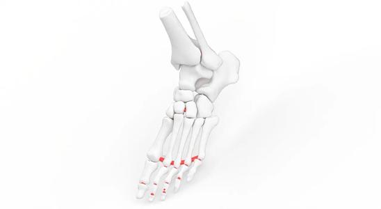 Life-sized Flexible Lower leg