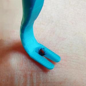 One more tick removal tool (with a precise tip)