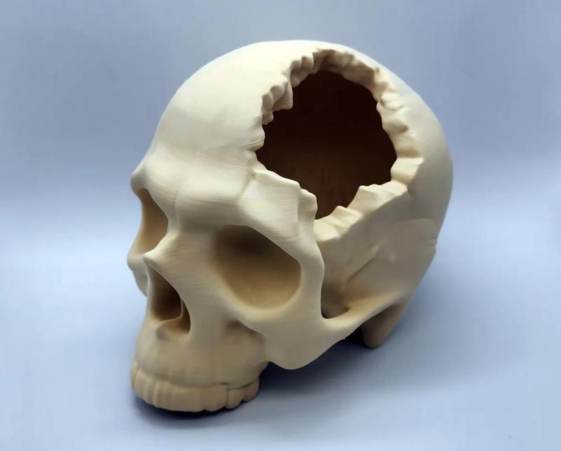 Major Headache Skull