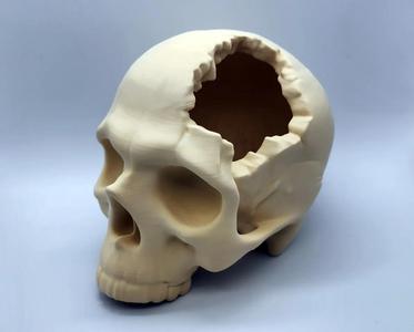 Major Headache Skull