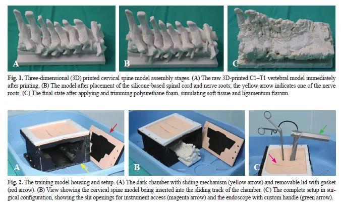 Posterior Cervical Spine Model #0   