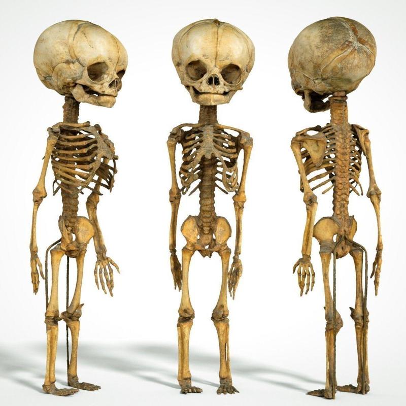 Foetus 3D printeable