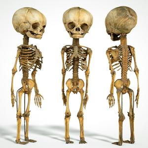 Foetus 3D printeable