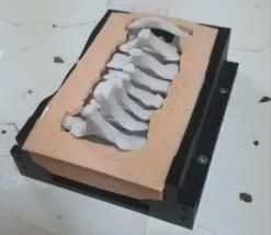 Open Posterior Cervical Box